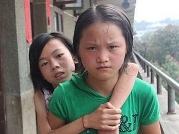 Gadis Ini Gendong Sang Sahabat yang Derita Penyakit Polio ke Sekolah Selama 3 Tahun